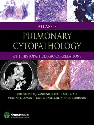 cover image of Atlas of Pulmonary Cytopathology